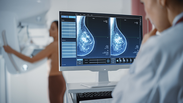 mammography uspstf